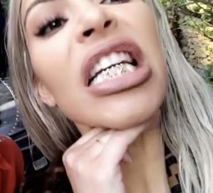 Kim Kardashian shows off her new grillz